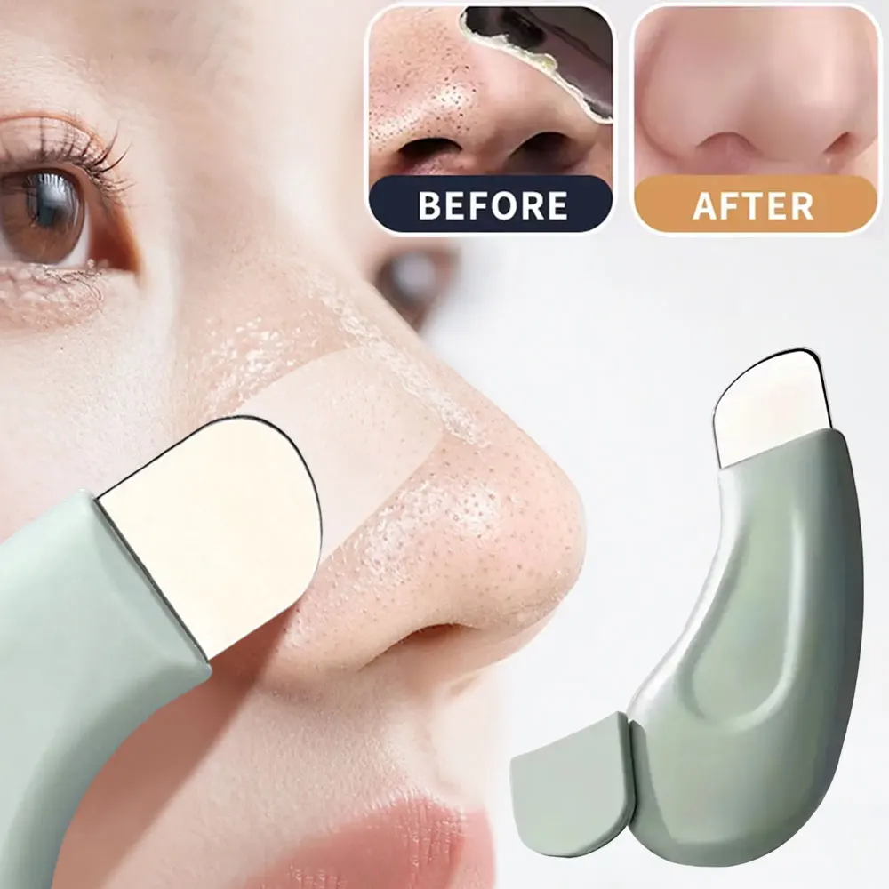 Nasal Aspirator - Gesichts-Pickelentferner, Tiefenreinigender Gesichtsspatel, Nasen-Pickelentferner, Porenreiniger, Hautpflege-Schönheitswerkzeug